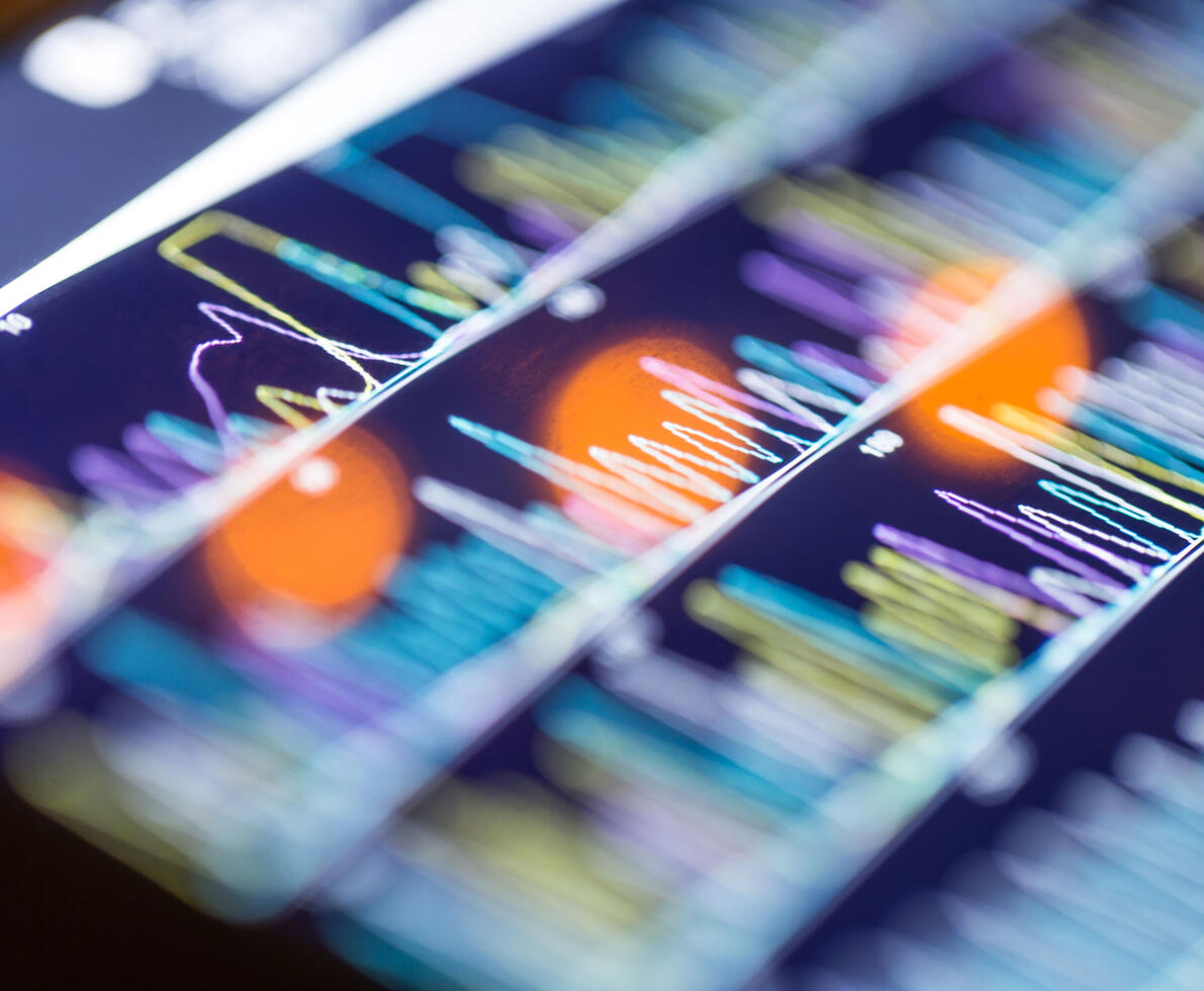 photo picture of data visualised as patterns