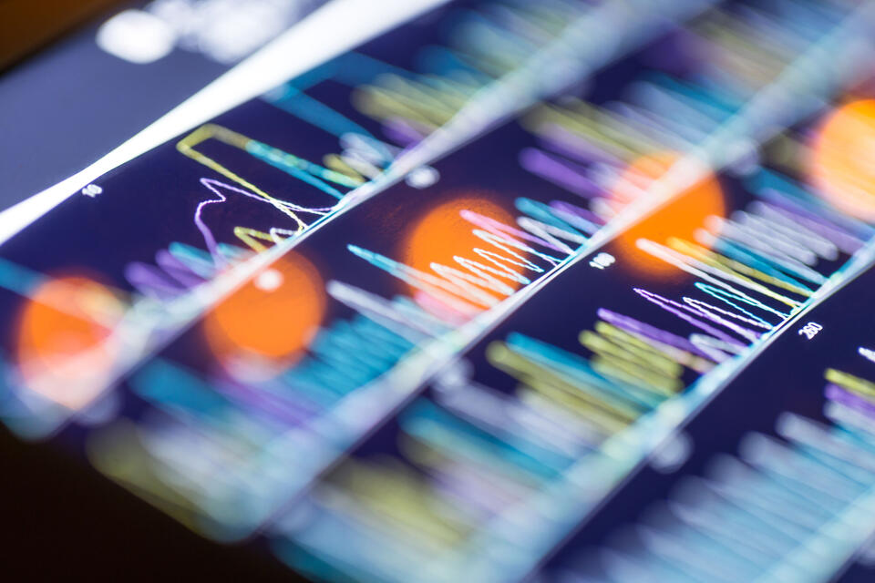 A screen displaying market trends